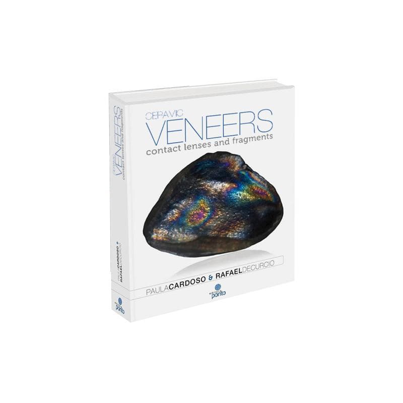 Ceramic Veneers Contact Lenses And Fragments 2018