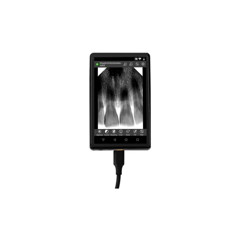 Portable Digital Imaging System