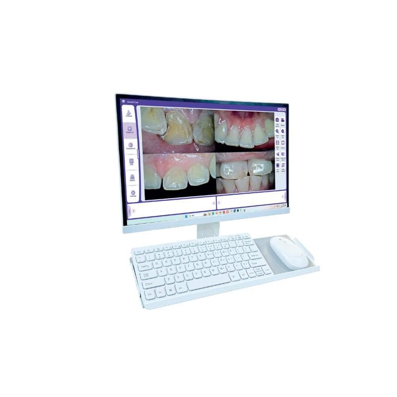 Mipoint Intraoral Camera 18 MegaPixel 19