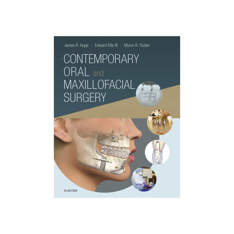 Contemporary Oral and Maxillofacial Surgery 2019