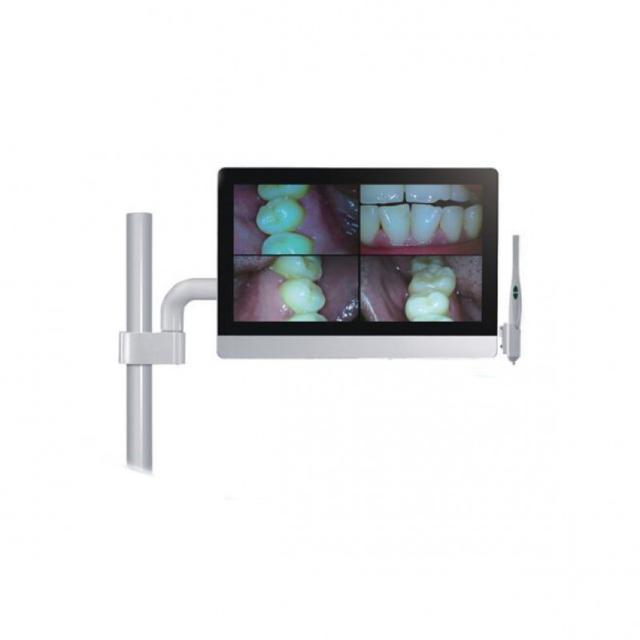 Intraoral Camera