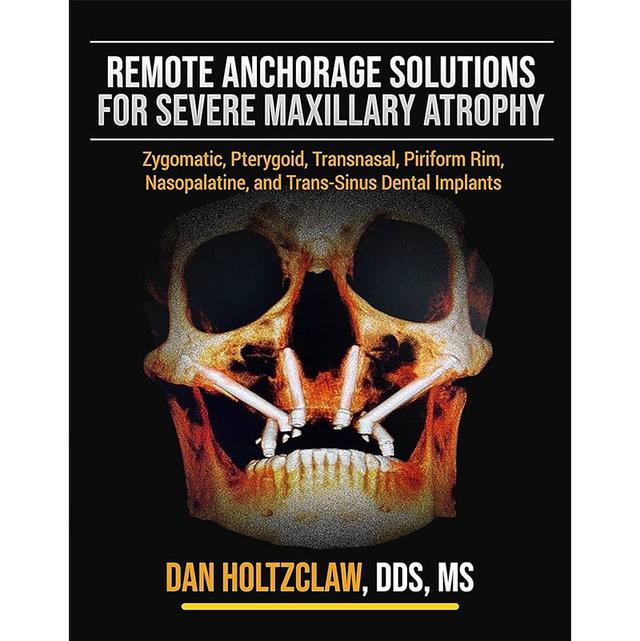 Remote Anchorage Solutions For Severe Maxillary Atrophy 2022