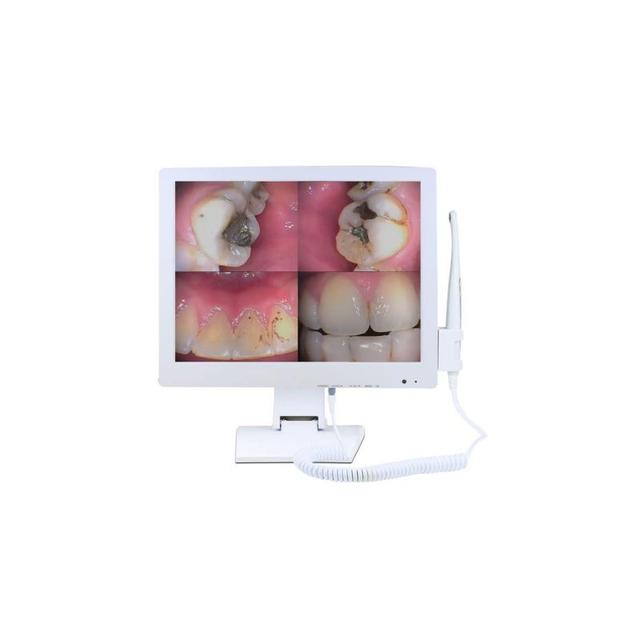 X-Smile Intra-Oral Camera With Screen 17 inch