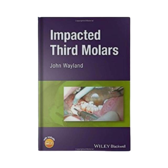 Impacted Third Molars